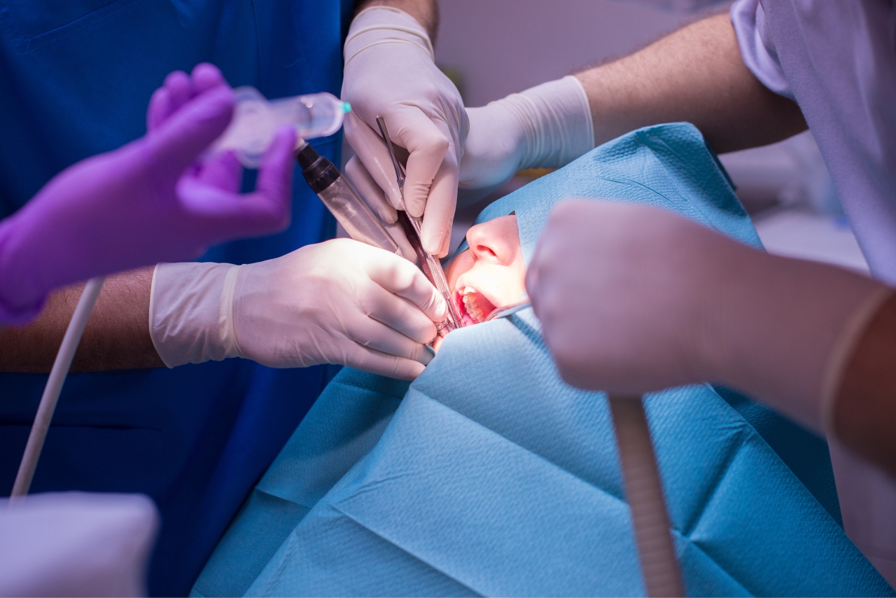Tratamientos Odontológicos que Requieren Cirugía