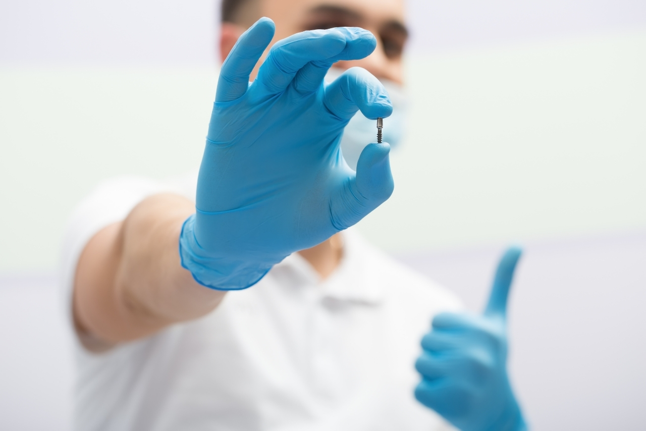 Implantes Dentales: Soluciones Fijas y Estéticas para Dientes Perdidos