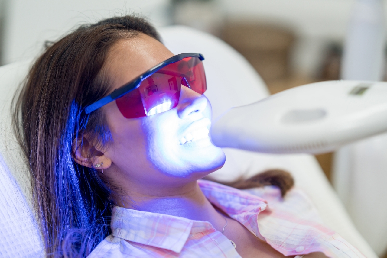 Blanqueamiento Dental Profesional