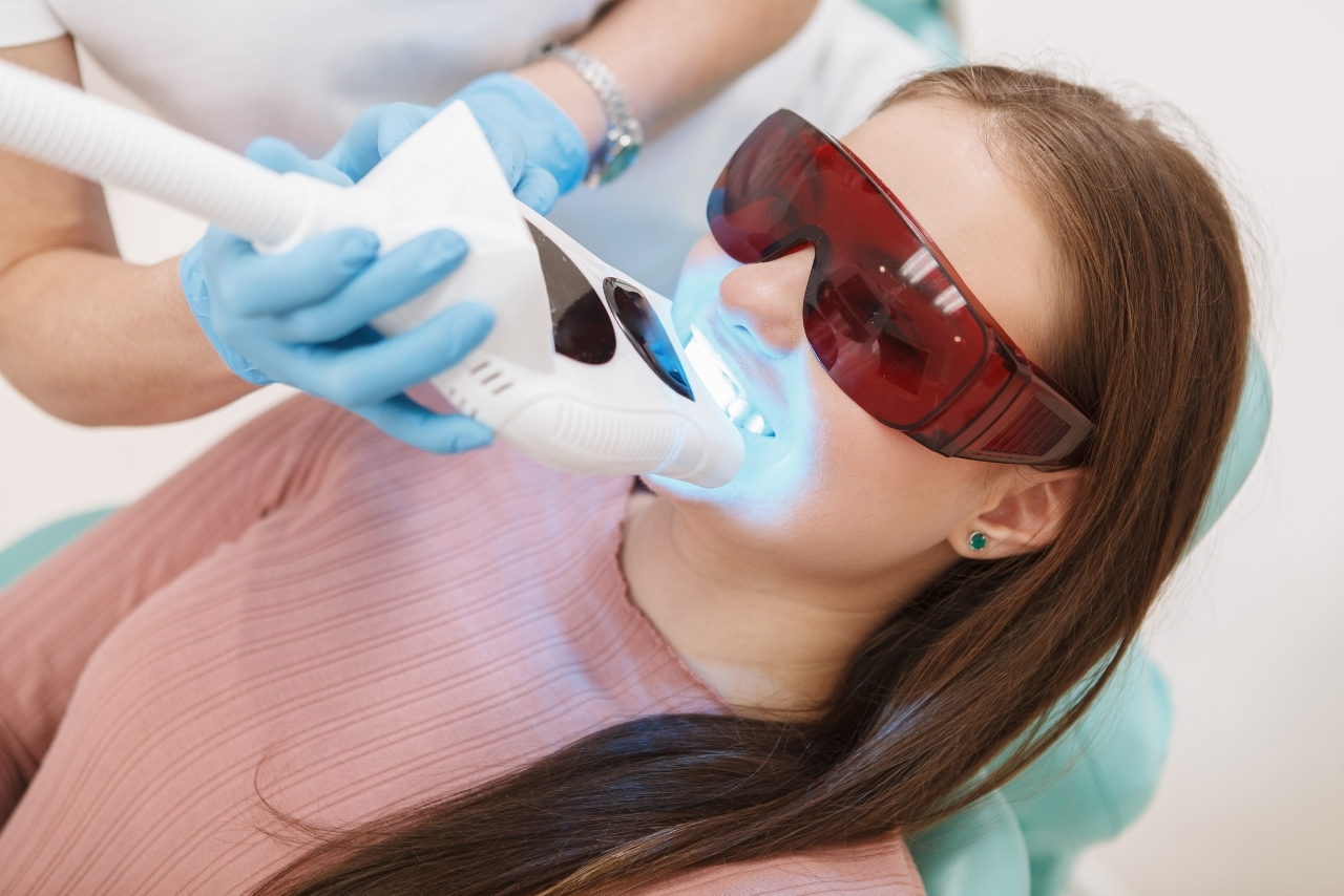 Blanqueamiento Dental Profesional