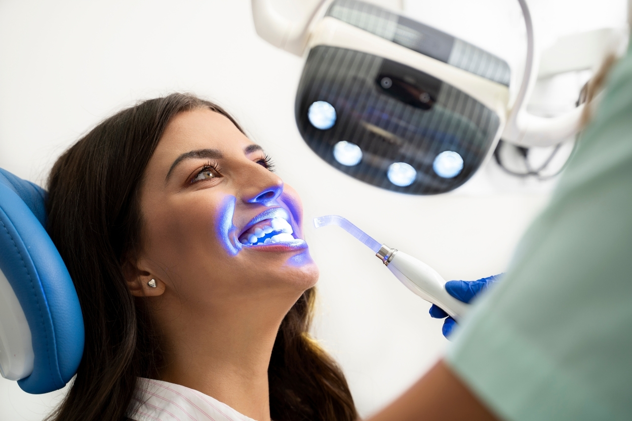 Blanqueamiento Dental Profesional