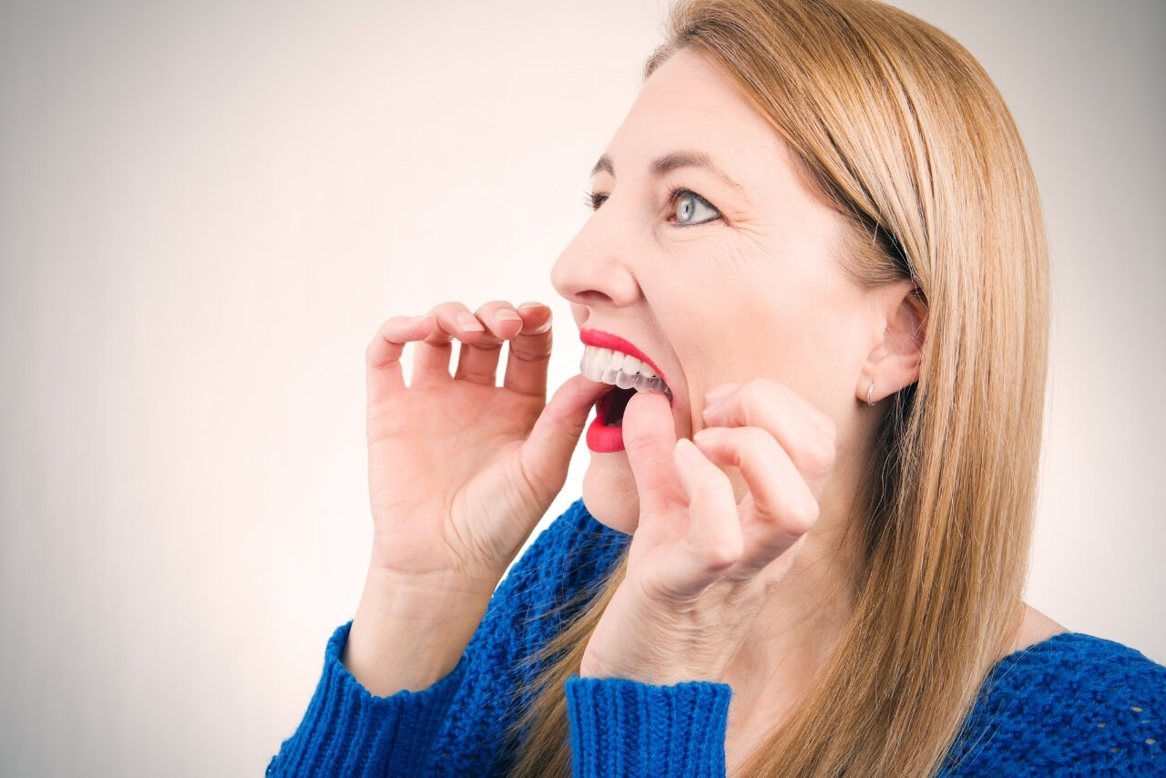 Ortodoncia en Adultos: ¿Por Qué Nunca Es Tarde para Corregir Tu Sonrisa?