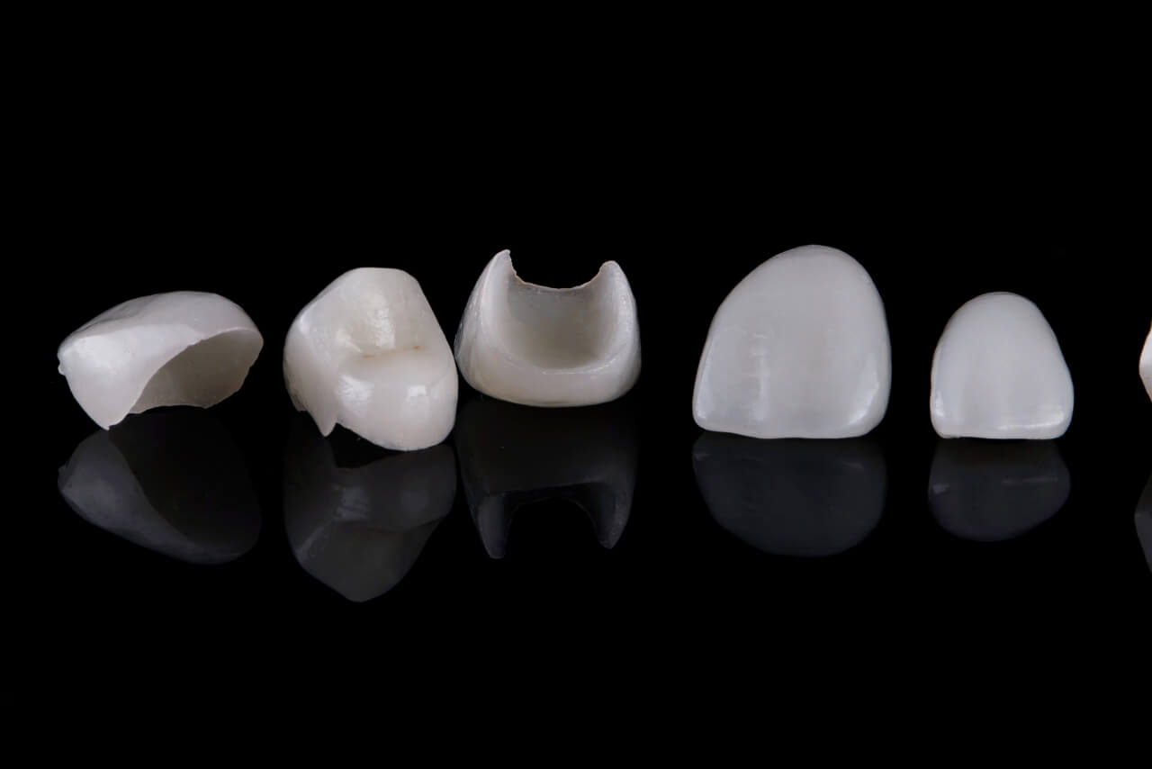 El Secreto Mejor Guardado de las Sonrisas Perfectas